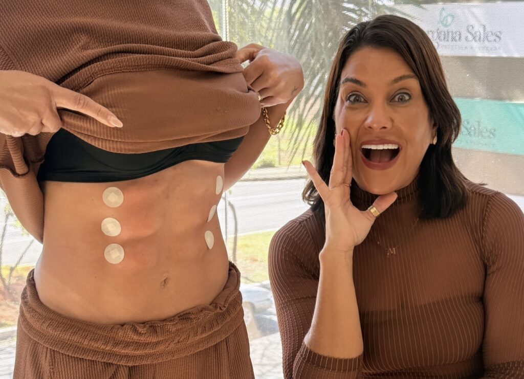 Harmonização abdominal amplia possibilidades para redefinir o contorno corporal sem cirurgia